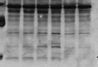 /album/fotogaleria-medium-spiny-neuron-labeled-with-dii-and-genegun/ko-bdnf-005-jpg/